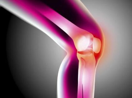 Deforming arthrosis