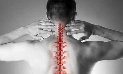 How does the osteocondrosis of cervical spine manifest