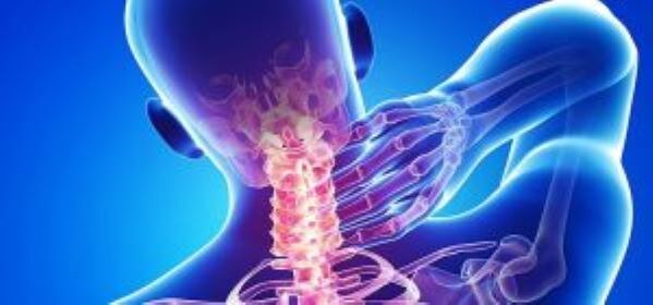 Cervical osteocondrosis