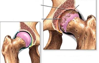 Diagnosis of hip artery