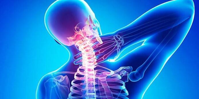 Cervical osteocondrosis